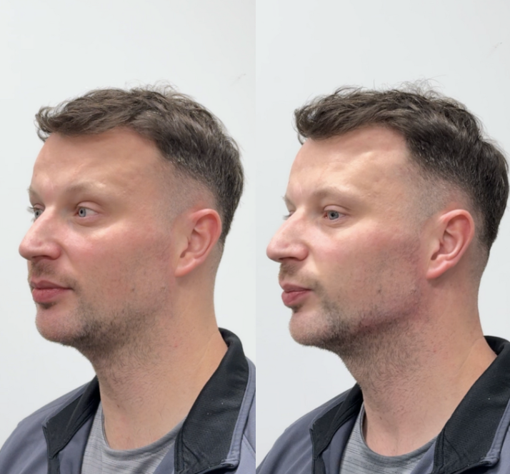Aesthetic Treatments for Men | Clinic22 Kilmarnock & Saltcoats