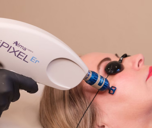 iPixel Laser Resurfacing: Restore Your Skin After Summer Sun Damage